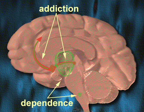 Image:addiction-dependence.gif