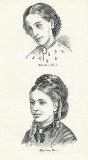 An anorexic female before and after treatment.