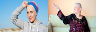 Hodgkin's Lymphoma vs Non-Hodgkin's Lymphoma