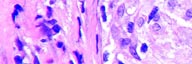 Apoptosis vs Necrosis