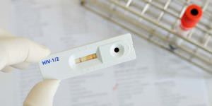 Blood tests and oral swabs are quick, easy, and inexpensive ways to test for HIV/AIDS.